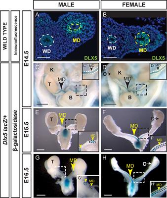 Distal-less homeobox genes Dlx5/6 regulate Müllerian duct regression